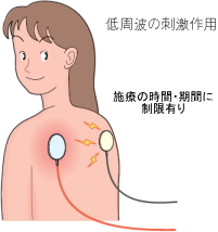 �C���f�B�o�G�}